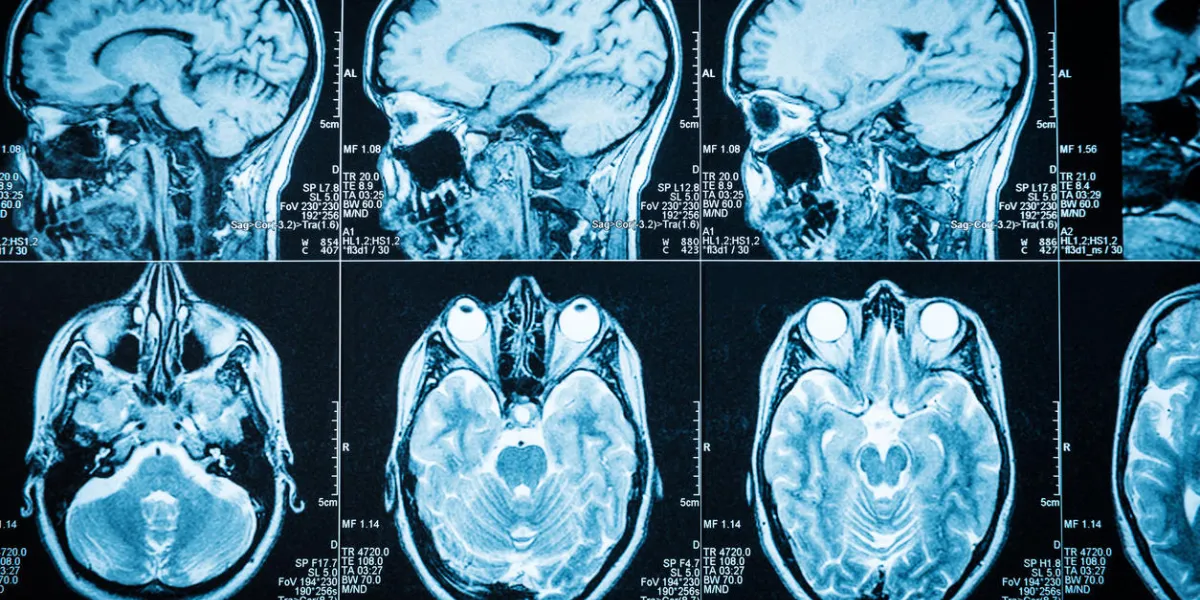 closeup of a ct scan with brain closeup of a ct scan with brain