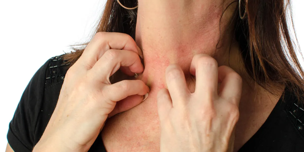 woman scratching her neck, isolated on white woman scratching her neck, isolated on white