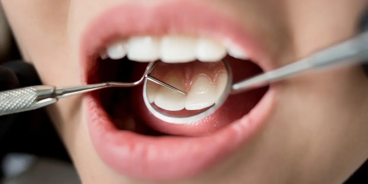 macro, coup, de, jeune femme, avoir, vérification dentaire, dans, dentiste, clinique dentiste, examiner, les, dents patient, avec, dentiste, outils, -, miroir, et, sonde, dentisterie macro, coup, de, jeune femme, avoir, vérification dentaire, dans, dentiste, clinique dentiste, examiner, les, dents patient, avec, dentiste, outils, -, miroir, et, sonde, dentisterie