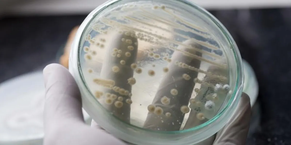 yeast in petri dish, microbiology for education in laboratories yeast in petri dish, microbiology for education in laboratories