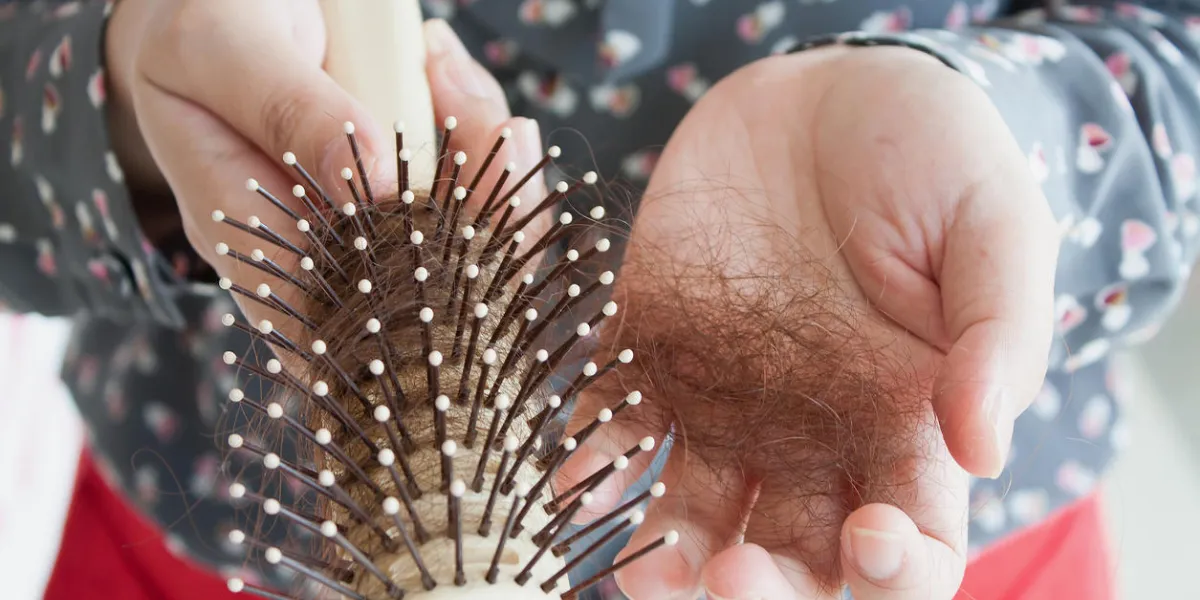 hair loss, hand holding hairbrush with lost hair