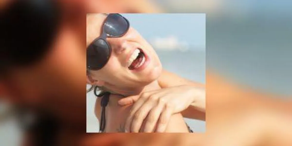 coup de soleil